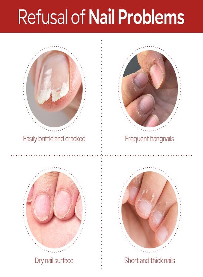 FREEORR Keratin Vitamins C Cuticle Oil, Improve Nail Gloss, Moisturizes Conditions and Strengthens Resilient Nail Care Oil for Daily Nourishment(1 Pc) - Image 5
